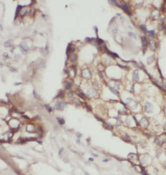CTNND1 Mouse Monoclonal Antibody