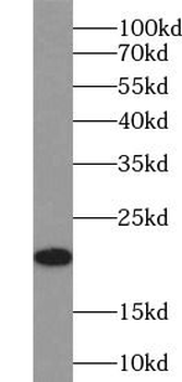 CDKN1A Rabbit Polyclonal Antibody