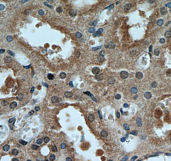 CDKN1A Rabbit Polyclonal Antibody