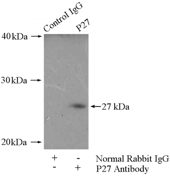 CDKN1B Antibody