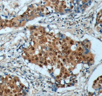 CDKN1B Antibody