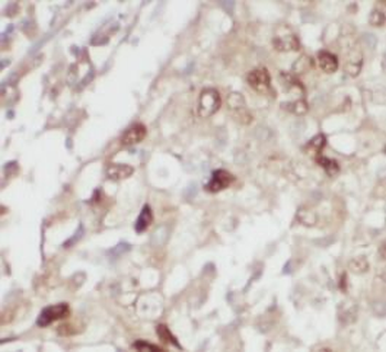 MAPK14 Antibody