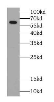 P4HA1 Antibody