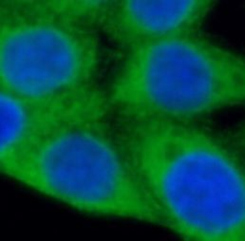 P4HA1 Antibody