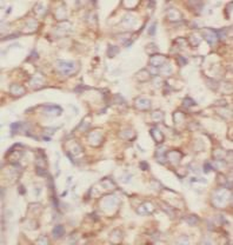 P4HA1 Antibody