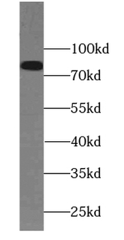 PAMR1 Antibody