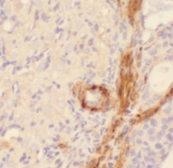 Pan-PAX Antibody