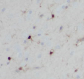 PCSK5 Antibody