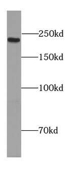 PCNX2 Rabbit Polyclonal Antibody
