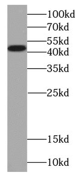 PCYT1B Rabbit Polyclonal Antibody