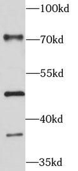 PTX3 Rabbit Polyclonal Antibody