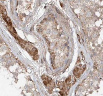 PRDX2 Antibody
