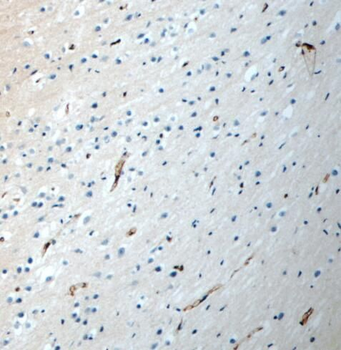 PEX5L Antibody