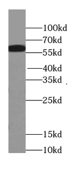 PFKFB3 Antibody