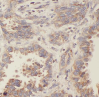 PFN2 Antibody