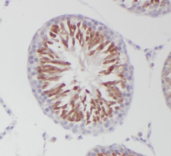 PGAP1 Antibody