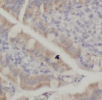 PGM1 Antibody