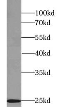 phospho TDP43 (403/404) Mouse Monoclonal Antibody
