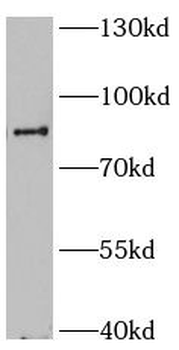 phospho Marcks (Ser167/170) Rabbit Polyclonal Antibody