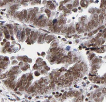 phospho-RCC1(Ser12) Antibody