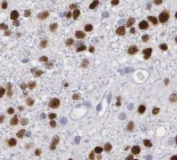PHOX2B Antibody