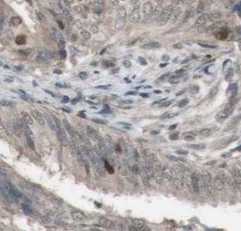 PIK3R5 Antibody