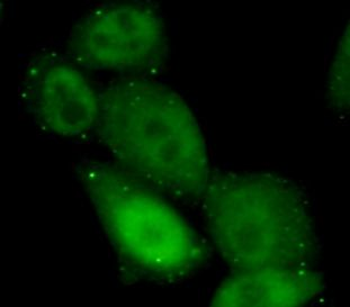 PIK3CB Rabbit Polyclonal Antibody