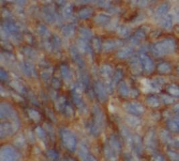 PIK3CB Rabbit Polyclonal Antibody