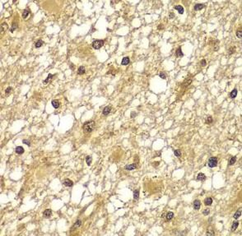 PIK3R3 Rabbit Polyclonal Antibody