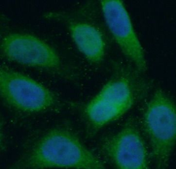 PIK3R1 Antibody
