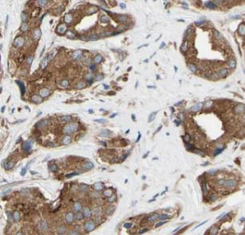 PIK3R1 Antibody