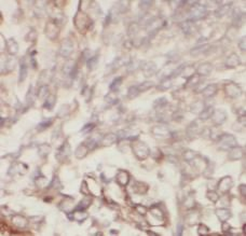PKM2 Antibody