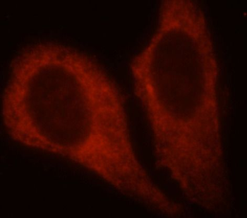 PKM2 Antibody