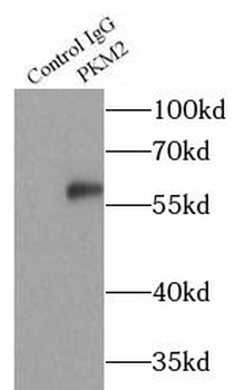 PKM2 Antibody