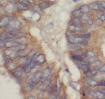 PKM2 Antibody