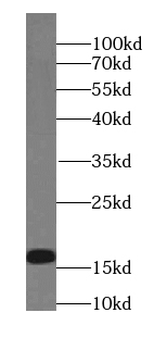 PLLP Rabbit Polyclonal Antibody