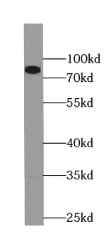 PLOD3 Mouse Monoclonal Antibody