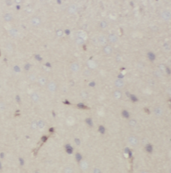 ATP2B2 Antibody