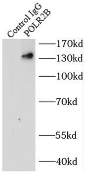 POLR2B Antibody