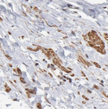 PPP1CB Antibody