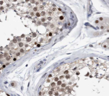 PPP1R2C Antibody
