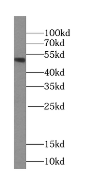 PSEN1 Specific Rabbit Polyclonal Antibody