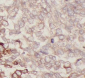 PRDX3 Rabbit Polyclonal Antibody