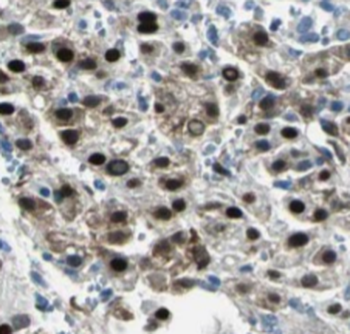 PSME4 Antibody