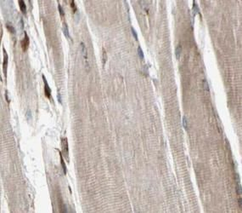 PYGM Antibody