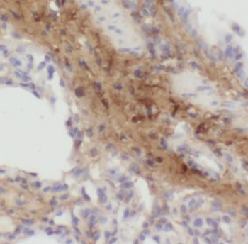 RAB11B Antibody