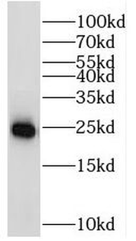 RAB11 Specific Rabbit Polyclonal Antibody