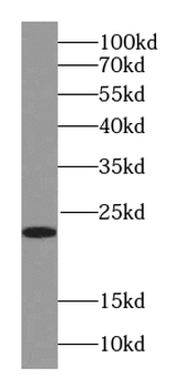 RAB18 Antibody
