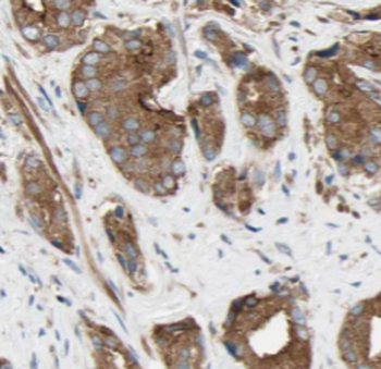RAB18 Antibody