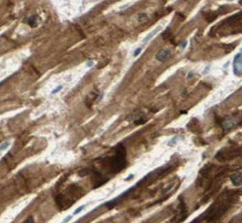 RAB31 Antibody